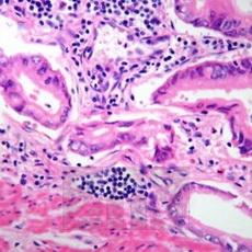 ������������ ������ (Mayers hematoxylin)