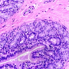 ������������ ������� (Harris haematoxylin)