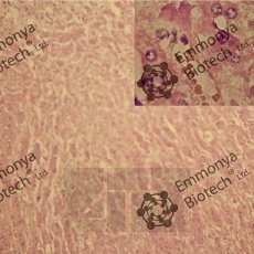 ������������ ������ I (Gill`s I haematoxylin)