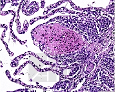 ������������ ������ III (Gill`s III haematoxylin)