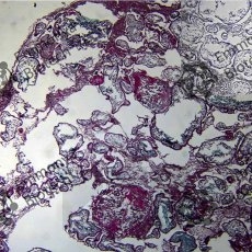 ������������ �������� � (Weigert Iron haematoxylin)