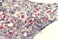 ������������ �������� � (Weigert Iron haematoxylin)