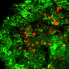 ����������� ��������� (Acridine orange)