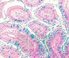 ����������� ����� �� 2.5 (Alcian blue pH 2.5)