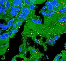 �������-������� (Auramine Rhodamine)