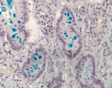 ����������� ����� �� 0,5 �����