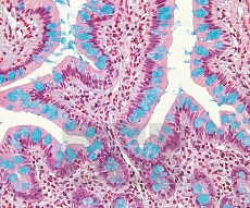 ����������� ����� �� 2,5 �����