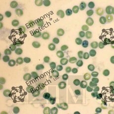 ������������� ���������� ����� (Brilliant cresyl blue)