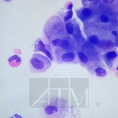 ������� ������������-����� (Giemsa)