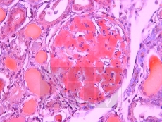 ����� �������, Puchtler