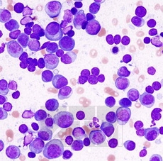 ������� �� ���-���������� (May Grunwald)