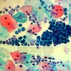 ����������� ��50 (Papanicolau EA50)