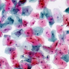 ����������� OG6 (Papanicolau OG6)