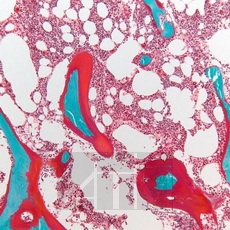 ��������-������� �� �������� (Light Green Goldner)