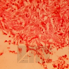 ����� ��� ��� (PAS) - ������� 