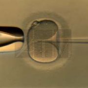 ��������������� ��������� Olympus IX73. �������������� in vitro.